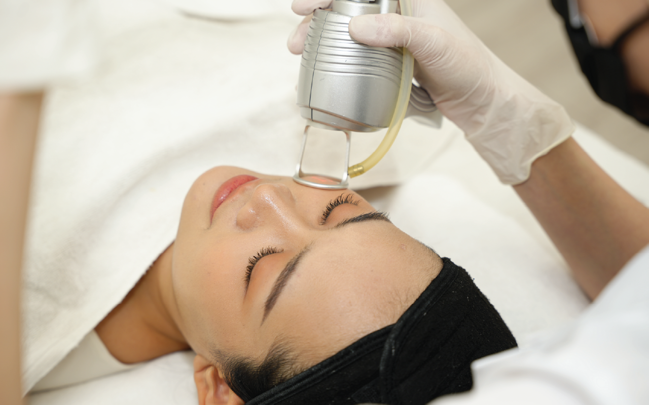CO₂ Laser fractional resurfacing