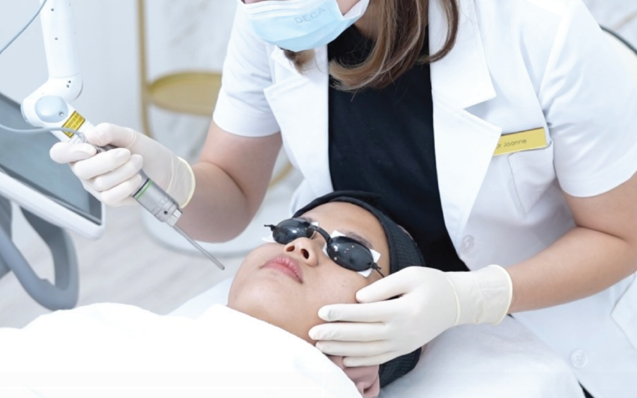 Pico Laser treatment for acne scars