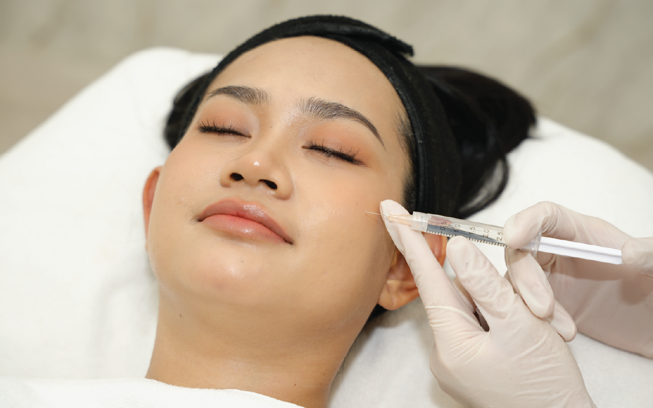 Subcision treatment for rolling scars